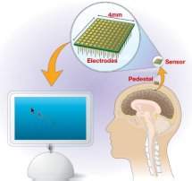 Neuroprtese permite controle de equipamentos pelo pensamento