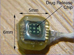 Micro-implante libera medicamentos no organismo durante um ano