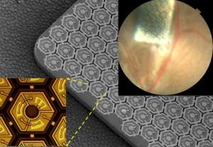 Olho binico a laser usa retina artificial de clulas solares