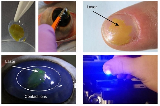 Viso laser do Super-Homem vir instalada em lentes de contato