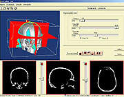 Programa de computador permite simulao de cirurgias