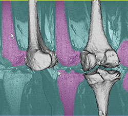Mdicos podero ver anatomia do paciente em 3-D sem cirurgia