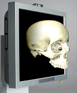 Imagens 3-D de tomografia so controladas  distncia pelo mdico