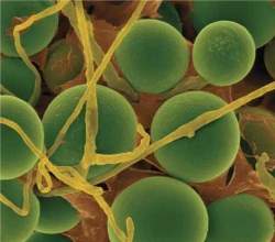 Biominerao usa bactrias e fungos para extrair metais