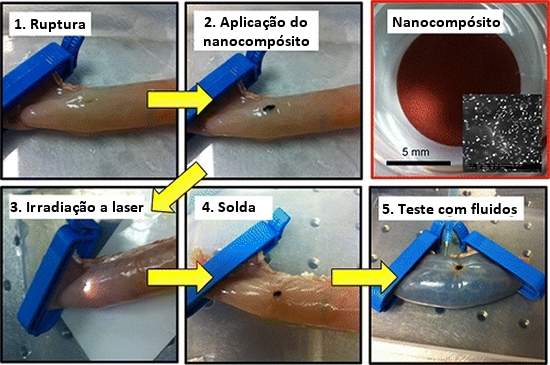 Solda a laser promete cirurgias sem pontos