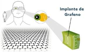 Bioeletrnica ganha impulso com transistores de grafeno
