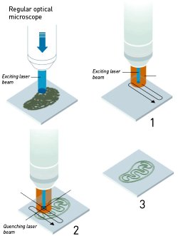 Nobel de Química 2014 premia transformação de microscópio em nanoscópio