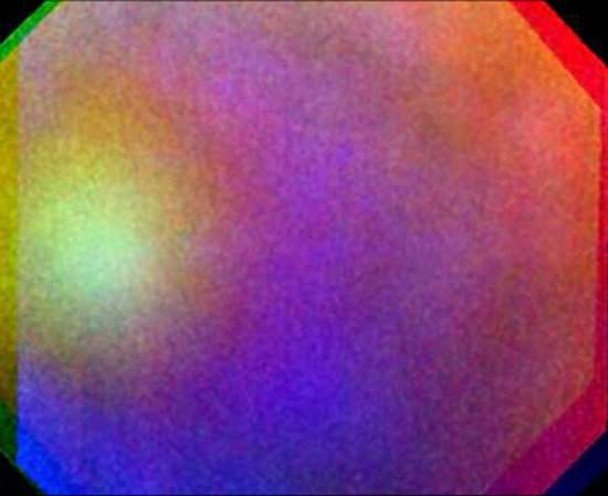Glria de Vnus: fenmeno  fotografado em outro planeta pela primeira vez