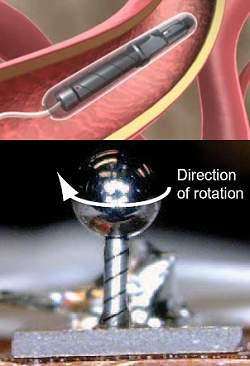 Micromotor viabiliza robs que navegam pelas veias e artrias
