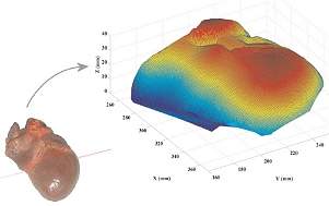 Robs operam corao batendo graas a visualizao 3D