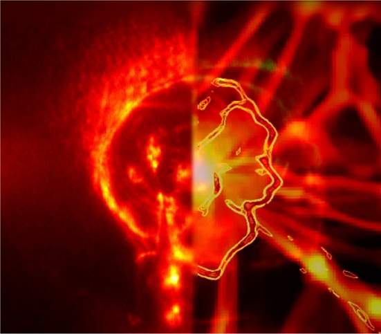 Explosão de laser mostra como magnetismo surgiu no Universo