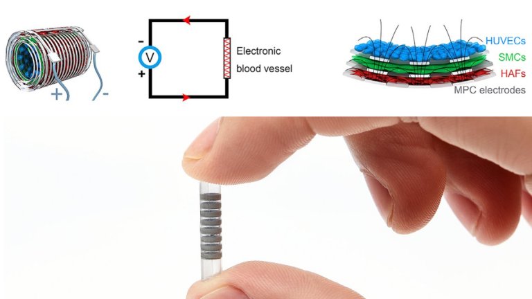 Veias eletrnicas vo monitorar voc por dentro