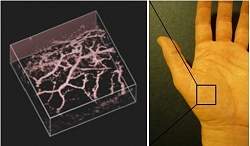 Luz e som geram imagens 3D de alta resoluo do interior do corpo humano