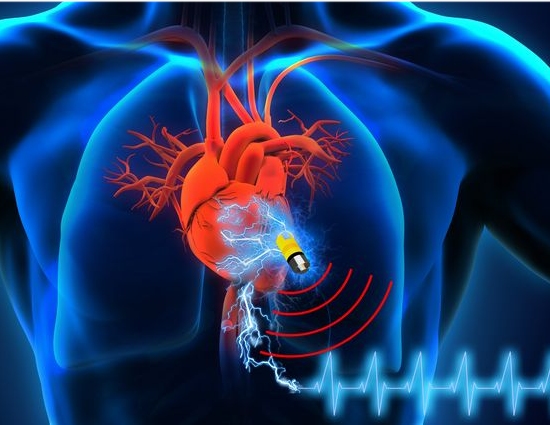 Energia biologicamente compatvel para implantes mdicos sem baterias