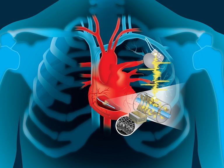 Marcapassos funciona com eletricidade gerada pelo próprio coração