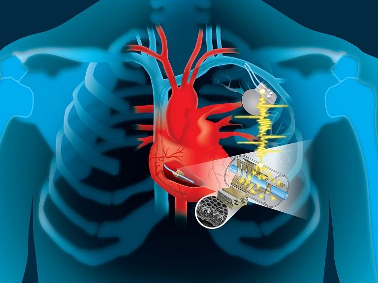 Marcapassos funciona com eletricidade gerada pelo prprio corao
