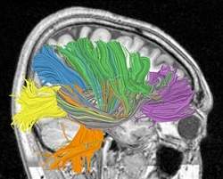Computador cognitivo ser inspirado no crebro de um camundongo