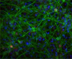 Inteligncia artificial prxima de replicar adaptao biolgica