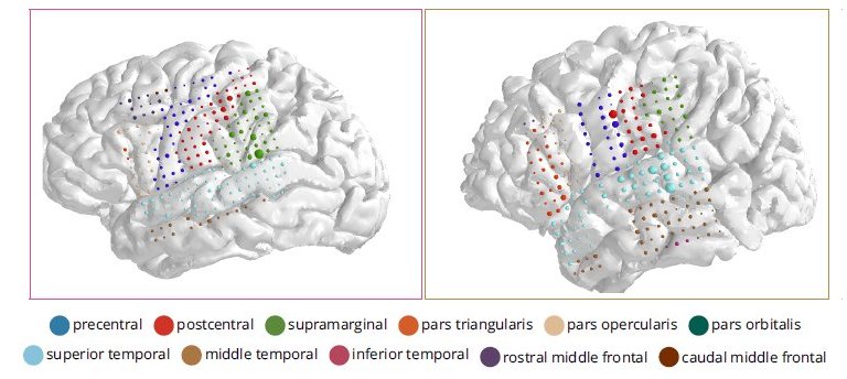 Inteligência artificial traduz pensamentos em frases