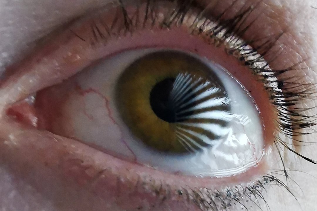 Viso sobre-humana: Tecnologia de rastreamento ocular enxerga o invisvel