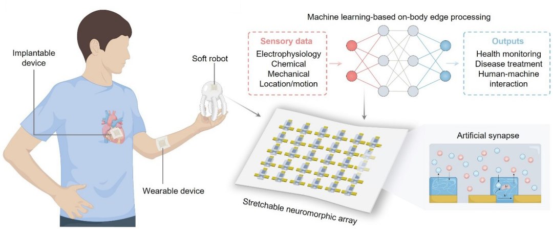 Curativo faz computação com inteligência artificial diretamente na pele