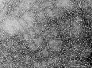 Cientistas vão construir orelha artificial de celulose