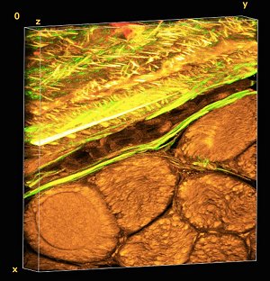 Tecidos biomimticos inteligentes copiam estrutura dos ossos