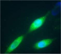 Nanotubos de carbono biocompatveis