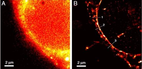 Novo microscpio ptico mostra HIV ao vivo e em cores