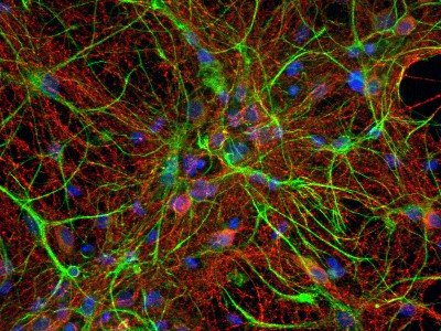 Nanotubos de carbono são ideais para crescimento de neurônios