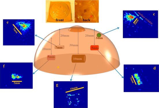 Pele eletrnica faz deteco precoce de cncer de mama