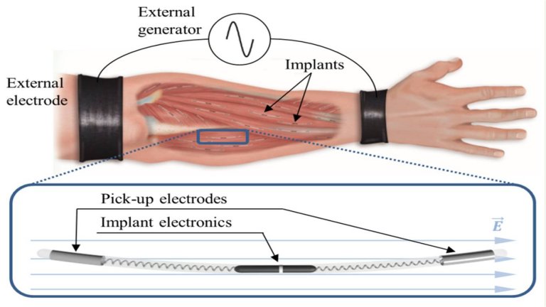 Corpo humano transfere energia mais que suficiente para implantes mdicos