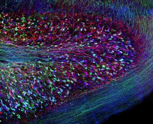 Massa cinzenta cerebral fotografada em cores